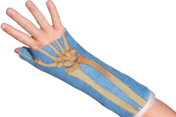 Gli adesivi “braccio rotto”