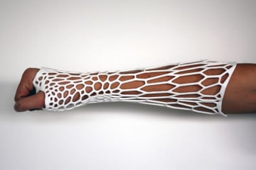 Cortex, il futuro del gesso medico